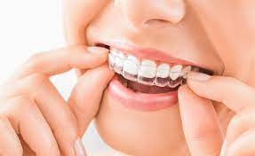 How does Invisalign move teeth