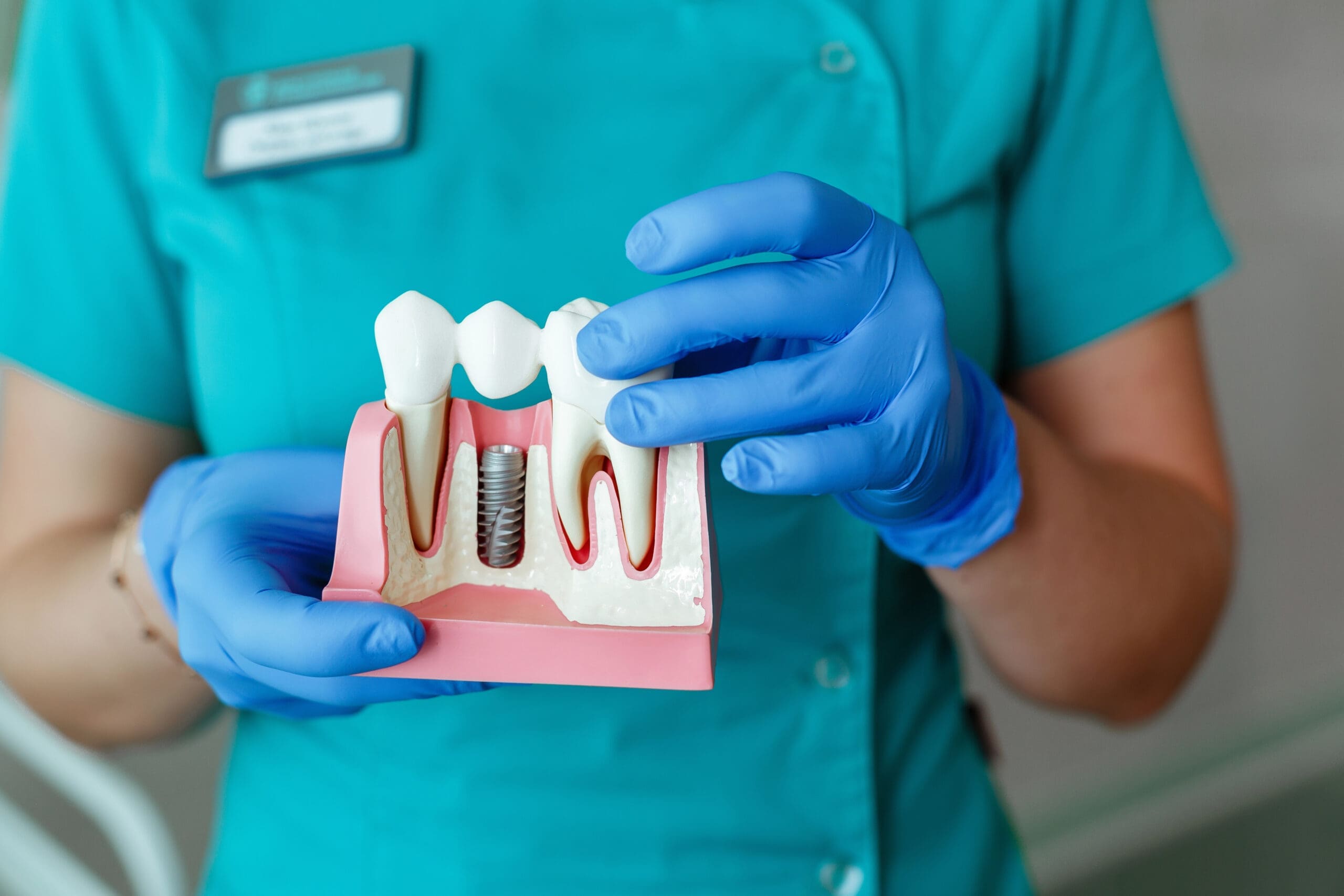 Compare Dental Implants vs Dentures Atlanta: Which is Better in 2024?